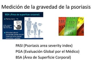 Medición de la gravedad de la psoriasis




      PASI (Psoriasis area severity index)
      PGA (Evaluación Global por el Médico)
      BSA (Área de Superficie Corporal)
 