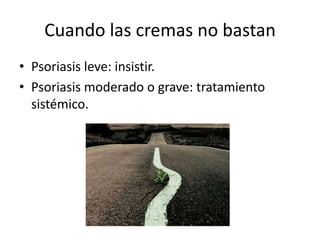 Cuando las cremas no bastan
• Psoriasis leve: insistir.
• Psoriasis moderado o grave: tratamiento
  sistémico.
 