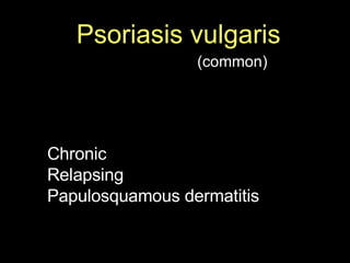 Psoriasis vulgaris   (common) Chronic  Relapsing Papulosquamous dermatitis 
