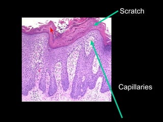 Capillaries Scratch  
