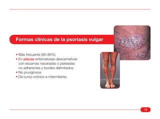 Formas clínicas de la psoriasis vulgar


• Más frecuente (80-90%).
• En placas eritematosas-descamativas
  con escamas nacaradas o plateadas
  no adherentes y bordes delimitados.
• No pruriginosa.
• De curso crónico e intermitente.




                                         10
 