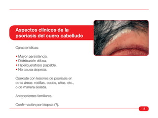 Aspectos clínicos de la
psoriasis del cuero cabelludo

Características:

• Mayor persistencia.
• Distribución difusa.
• Hiperqueratosis palpable.
• No causa alopecia.

Coexiste con lesiones de psoriasis en
otras áreas: rodillas, codos, uñas, etc.,
o de manera aislada.

Antecedentes familiares.

Confirmación por biopsia (?).
                                            14
 