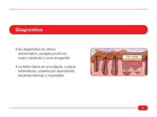 Diagnóstico



• Su diagnóstico es clínico:
  asintomático, excepto prurito en
                                            Piel normal
  cuero cabelludo y zona anogenital.

• La lesión típica es una pápula, o placa
  eritematosa, cubierta por abundantes
  escamas blancas y nacaradas.




                                                          5
 