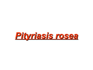 Pityriasis rosea 