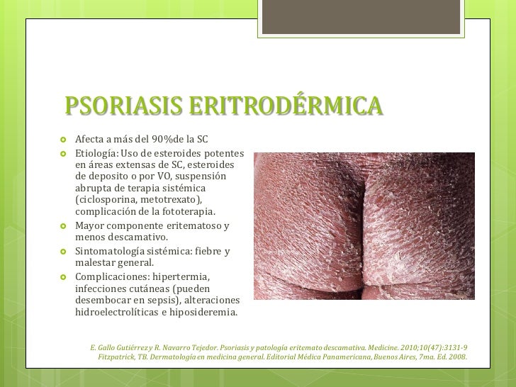 Libro De Dermatologia Fitzpatrick