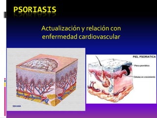 PSORIASIS

     Actualización y relación con
     enfermedad cardiovascular
 