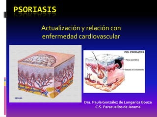 PSORIASIS

     Actualización y relación con
     enfermedad cardiovascular




                    Dra. Paula González de Langarica Bouza
                          C.S. Paracuellos de Jarama
 