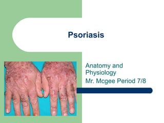 Psoriasis


    Anatomy and
    Physiology
    Mr. Mcgee Period 7/8
 