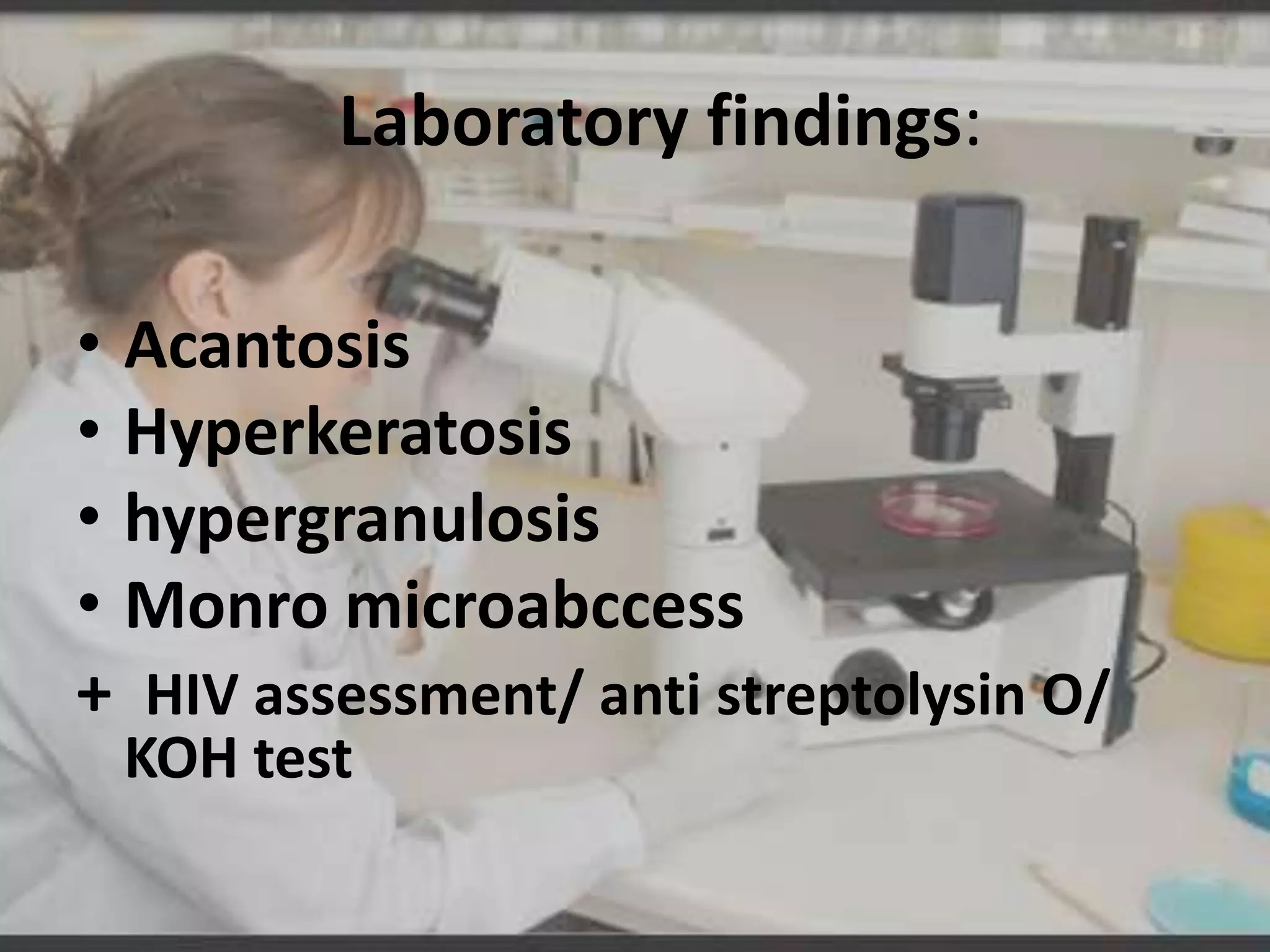 Laboratory findings:
• Acantosis
• Hyperkeratosis
• hypergranulosis
• Monro microabccess
+ HIV assessment/ anti streptolysin O/
KOH test

 