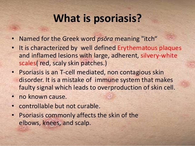 Psoriasis Causes And Risk Factors Risk Factors