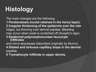 Histology
The main changes are the following.
1 Parakeratosis (nuclei retained in the horny layer).
2 Irregular thickening of the epidermis over the rete
ridges, but thinning over dermal papillae. Bleeding
may occur when scale is scratched off (Auspitz’s sign).
3 Epidermal polymorphonuclear leucocyte
infiltrates
and micro-abscesses (described originally by Munro).
4 Dilated and tortuous capillary loops in the dermal
papillae.
5 T-lymphocyte infiltrate in upper dermis.
 