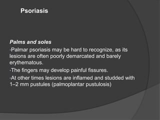 Palms and soles
•Palmar psoriasis may be hard to recognize, as its
lesions are often poorly demarcated and barely
erythematous.
•The fingers may develop painful fissures.
•At other times lesions are inflamed and studded with
1–2 mm pustules (palmoplantar pustulosis)
Psoriasis
 