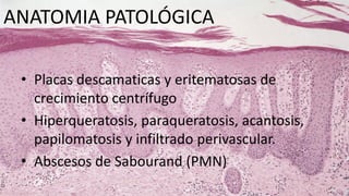 ANATOMIA PATOLÓGICA
• Placas descamaticas y eritematosas de
crecimiento centrífugo
• Hiperqueratosis, paraqueratosis, acantosis,
papilomatosis y infiltrado perivascular.
• Abscesos de Sabourand (PMN)
 