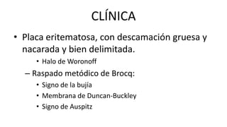 CLÍNICA
• Placa eritematosa, con descamación gruesa y
nacarada y bien delimitada.
• Halo de Woronoff
– Raspado metódico de Brocq:
• Signo de la bujía
• Membrana de Duncan-Buckley
• Signo de Auspitz
 