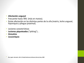 • Afectación ungueal
• Frecuente hasta 78% (más en manos).
• Existe afectación en las distintas partes de la uña (matriz, lecho ungueal,
hiponiquio y pliegue proximal).
• Lesiones características
• Lesiones piqueteadas ("pitting"). .
• Onicolisis
• Leuconiquia
• Rev. argent. dermatol. v.90 n.3 Ciudad Autónoma de Buenos Aires jul./sep. 2009
 