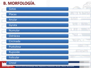 B. MORFOLOGÍA.
Gotas
Placas
Anular
Gyrata
Numular
Ostrácea
Circinada
Pustulosa
Rupioide
Folicular
Lineal
Arenas R (2015) Dermatología. Atlas, diagnóstico y tratamiento., 6ta edn., México: McGrawHill.
 