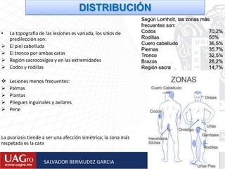 DISTRIBUCIÓN
Según Lomholt, las zonas más
frecuentes son:
Codos 70,2%
Rodillas 50%
Cuero cabelludo 36,5%
Piernas 35,7%
Tronco 32,5%
Brazos 28,2%
Región sacra 14,7%
• La topografía de las lesiones es variada, los sitios de
predilección son:
 El piel cabelluda
 El tronco por ambas caras
 Región sacrocoxígea y en las extremidades
 Codos y rodillas
 Lesiones menos frecuentes:
 Palmas
 Plantas
 Pliegues inguinales y axilares
 Pene
La psoriasis tiende a ser una afección simétrica; la zona más
respetada es la cara
SALVADOR BERMUDEZ GARCIA
 