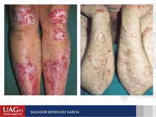 SALVADOR BERMUDEZ GARCIA
 