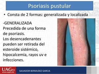 Psoriasis pustular
• Consta de 2 formas: generalizada y localizada
-GENERALIZADA
Precedida de una forma
de psoriasis.
Los desencadenantes
pueden ser retirada del
esteroide sistémico,
hipocalcemia, rayos uv e
infecciones.
SALVADOR BERMUDEZ GARCIA
 