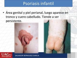 Psoriasis infantil
• Área genital y piel perianal, luego aparece en
tronco y cuero cabelludo. Tiende a ser
persistente.
SALVADOR BERMUDEZ GARCIA
 