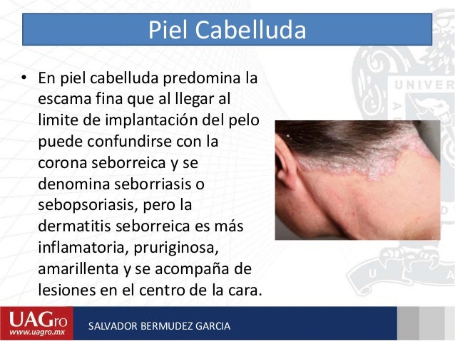 Los diarios de la eccema verdadera