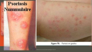 Dr. Benkourdel interne en service de dermatologie C.H.U.O
 