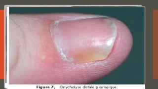 Dr. Benkourdel interne en service de dermatologie C.H.U.O
 