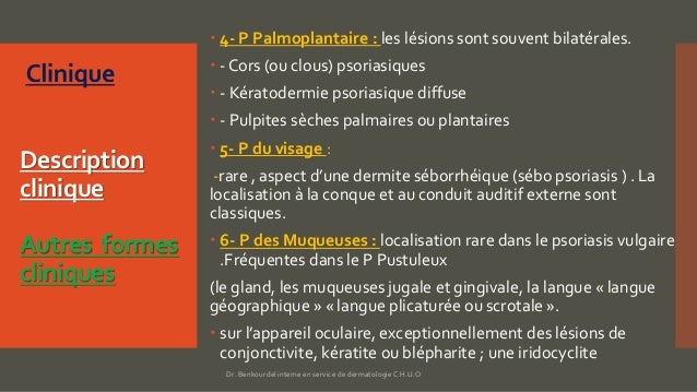 Le psoriasis par la lampe à quartz