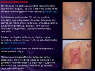Red Periphery Psoriasis | PPTX