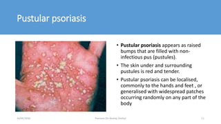 Pustular psoriasis
• Pustular psoriasis appears as raised
bumps that are filled with non-
infectious pus (pustules).
• The skin under and surrounding
pustules is red and tender.
• Pustular psoriasis can be localised,
commonly to the hands and feet , or
generalised with widespread patches
occurring randomly on any part of the
body
16/05/2020 Psoriasis (Dr Akshay Shetty) 11
 