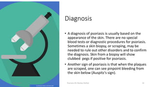 Diagnosis
• A diagnosis of psoriasis is usually based on the
appearance of the skin. There are no special
blood tests or diagnostic procedures for psoriasis.
Sometimes a skin biopsy, or scraping, may be
needed to rule out other disorders and to confirm
the diagnosis. Skin from a biopsy will show
clubbed pegs if positive for psoriasis.
• Another sign of psoriasis is that when the plaques
are scraped, one can see pinpoint bleeding from
the skin below (Auspitz's sign).
This Photo by Unknown Author is licensed under CC BY-SA
16/05/2020 Psoriasis (Dr Akshay Shetty) 14
 