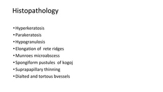 Histopathology
•Hyperkeratosis
•Parakeratosis
•Hypogranulosis
•Elongation of rete ridges
•Munroes microabscess
•Spongiform pustules of kogoj
•Suprapapillary thinning
•Dialted and tortous bvessels
 