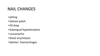 NAIL CHANGES
•pitting
•Salmon patch
•Oil drop
•Subungual hyperkeratosis
•Leuconychia
•Distal onycholysis
•Splinter haemarrhages
 
