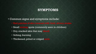 SYMPTOMS
• Common signs and symptoms include:
• Red patches of skin covered with thick, silvery scales
• Small scaling spots (commonly seen in children)
• Dry, cracked skin that may bleed
• Itching, burning
• Thickened, pitted or ridged nails
 