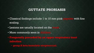 GUTTATE PSORIASIS
• Classical findings include 1 to 10 mm pink papules with fine
scaling.
• Lesions are usually located on the trunk.
• More commonly seen in children.
• Frequently preceded by an upper respiratory tract
infection
• group A beta-hemolytic streptococcal.
 