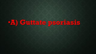 •A) Guttate psoriasis
 