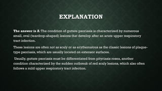 EXPLANATION
The answer is A:The condition of guttate psoriasis is characterized by numerous
small, oval (teardrop-shaped) lesions that develop after an acute upper respiratory
tract infection.
These lesions are often not as scaly or as erythematous as the classic lesions of plaque-
type psoriasis, which are usually located on extensor surfaces.
Usually, guttate psoriasis must be differentiated from pityriasis rosea, another
condition characterized by the sudden outbreak of red scaly lesions, which also often
follows a mild upper respiratory tract infection.
 