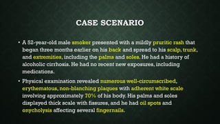 CASE SCENARIO
• A 52-year-old male smoker presented with a mildly pruritic rash that
began three months earlier on his back and spread to his scalp, trunk,
and extremities, including the palms and soles. He had a history of
alcoholic cirrhosis. He had no recent new exposures, including
medications.
• Physical examination revealed numerous well-circumscribed,
erythematous, non-blanching plaques with adherent white scale
involving approximately 70% of his body. His palms and soles
displayed thick scale with fissures, and he had oil spots and
onycholysis affecting several fingernails.
 