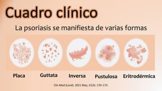 Cuadro clínico
La psoriasis se manifiesta de varias formas
Placa Guttata Inversa Pustulosa Eritrodérmica
Clin Med (Lond). 2021 May; 21(3): 170–173.
 