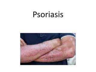 Psoriasis
 