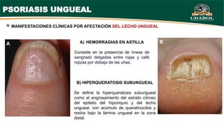Pyrosis Define PSORIASIS - APRESENTAÇÃO ATUALIZADO grupo D.pptx