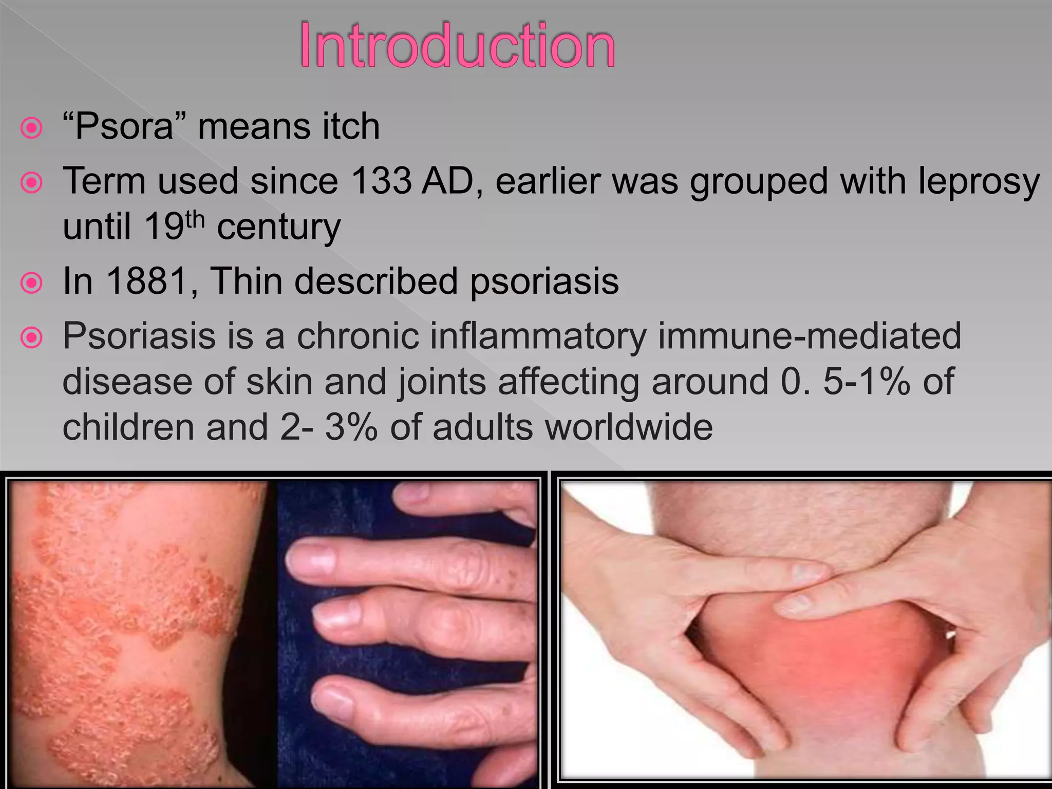 Psoriasis recent advances and existing therapy in psoriasis | PPTX