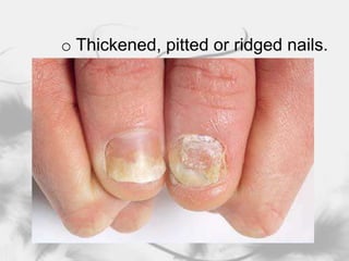 Body-wide (systemic) medications, which are pills or injections that affect the whole body, not just the skin