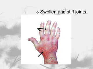 Phototherapy, which uses light to treat psoriasis.Diseases