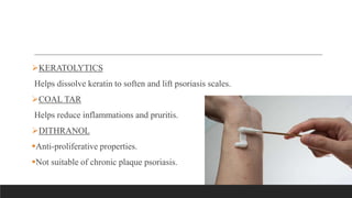 KERATOLYTICS
Helps dissolve keratin to soften and lift psoriasis scales.
COAL TAR
Helps reduce inflammations and pruritis.
DITHRANOL
Anti-proliferative properties.
Not suitable of chronic plaque psoriasis.
 