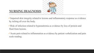 NURSING DIAGNOSIS
Impaired skin integrity related to lesions and inflammatory response as evidence
by itching all over the body.
Risk of infection related to hyponatremia as evidence by loss of protein and
fluid from lesions.
Acute pain related to inflammation as evidence by patient verbalization and pain
scale reading.
 