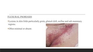 FLEXURAL PSORIASIS
Lesions in skin folds particularly groin, gluteal cleft, axillae and sub mammary
regions.
Often minimal or absent.
 