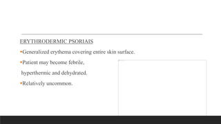 ERYTHRODERMIC PSORIAIS
Generalized erythema covering entire skin surface.
Patient may become febrile,
hyperthermic and dehydrated.
Relatively uncommon.
 