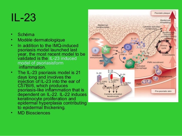 Psoriasis 14 Psoriasis 14