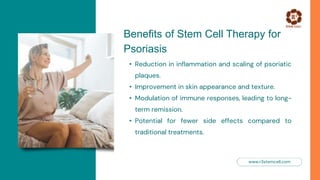Psoriasis and Stem Cell Therapy: A Ray of Light for Patients | Dr. David Greene